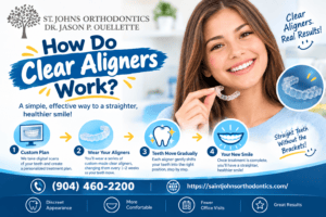 How Do Clear Aligners Work?