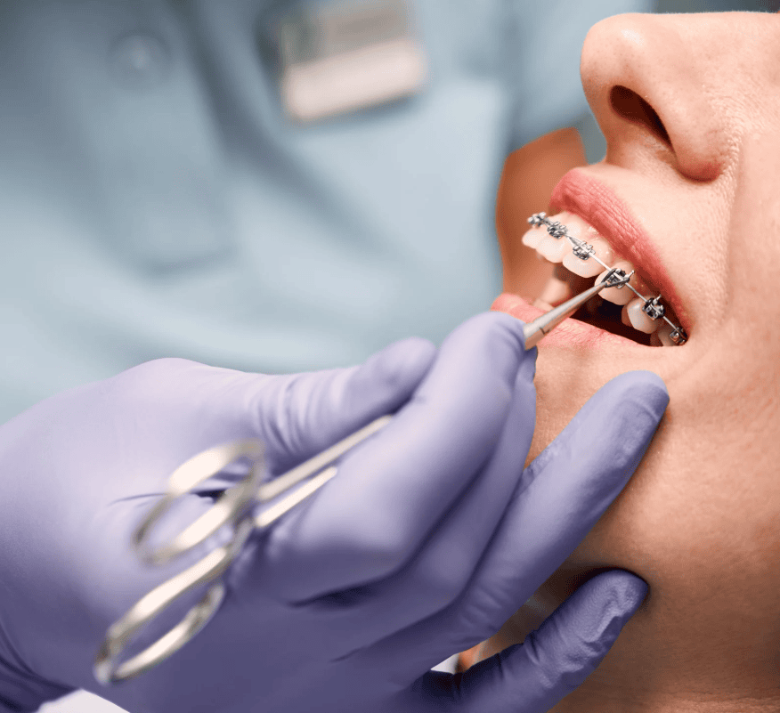 What Age Should You See an Orthodontist?