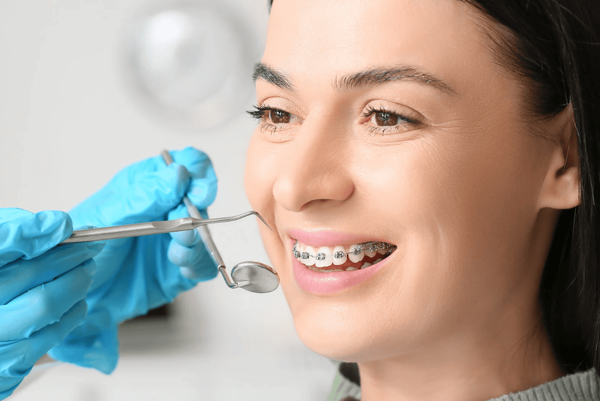 The Short Answer: Braces Treatment Duration for Kids